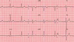 Corso di formazione  sull'interpretazione del Tracciato Elettrocardiografico